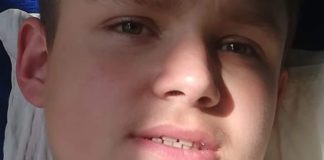 14-letni Artur z Rzezawy potrzebuje pomocy. Trwa zbiórka pieniędzy