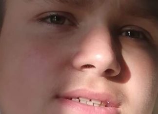 14-letni Artur z Rzezawy potrzebuje pomocy. Trwa zbiórka pieniędzy