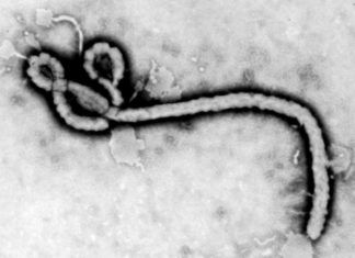 W Kongo, dotkniętym koronawirusem, odżyła ebola