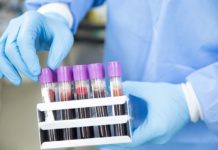 Bochnia. Koronawirus znów w DPS? W ośrodku czekają na wynik drugiego testu