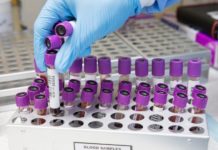 Na apel o oddanie osocza dla lekarki z Bochni odpowiedziało blisko 50 osób. Rodzina dziękuje