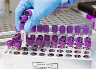 Badania: grupa krwi może wpływać na przebieg COVID-19