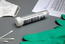 Ekspert: po włączeniu do diagnostyki testów antygenowych będzie duży wzrost zakażeń