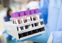 Kolejny apel o osocze ozdrowieńców. Potrzebuje go nauczycielka I LO walcząca z Covid-19