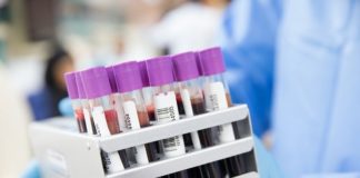 Kolejny apel o osocze ozdrowieńców. Potrzebuje go nauczycielka I LO walcząca z Covid-19