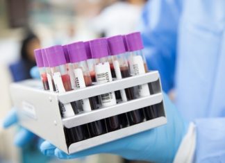 Kolejny apel o osocze ozdrowieńców. Potrzebuje go nauczycielka I LO walcząca z Covid-19