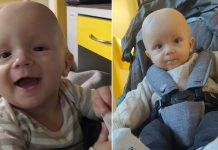 „Państwa synek ma guza mózgu”. Roczny Antoś z Bratucic walczy o życie