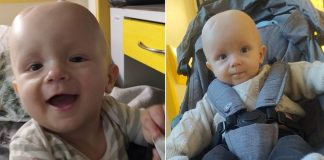 „Państwa synek ma guza mózgu”. Roczny Antoś z Bratucic walczy o życie