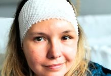 Paulina z Kłaja potrzebuje pomocy. Trwa zbiórka funduszy na kosztowną operację