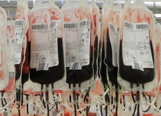 Nie będzie likwidacji bocheńskiego oddziału krwiodawstwa. Planowana czasowa przeprowadzka